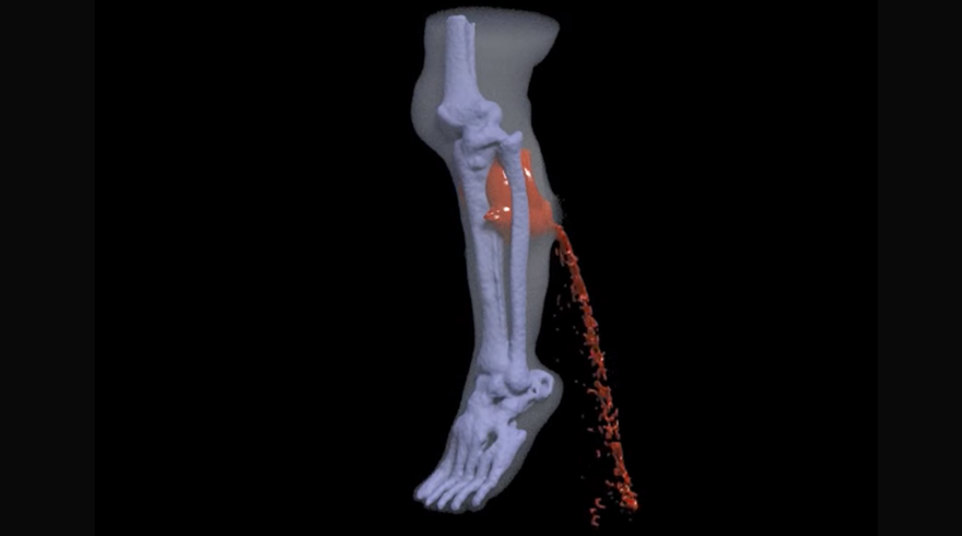 This real-life injury simulator is fascinating if a little gross